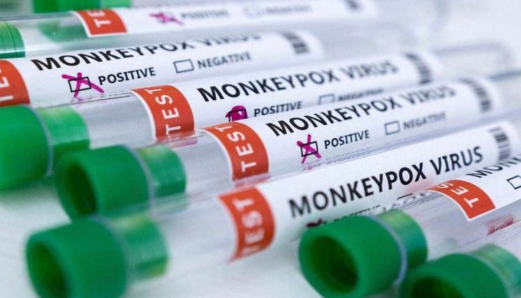 Kerala Man, Who Showed Monkey Pox Symptoms After Arriving From UAE, Dies