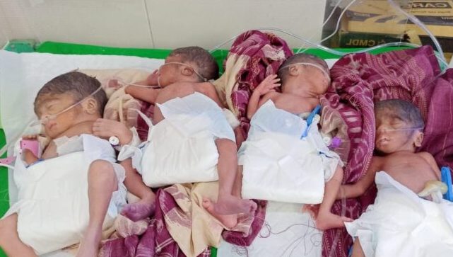 Four Times The Joy! Woman Gives Birth To Quadruplets In Odisha’s VIMSAR