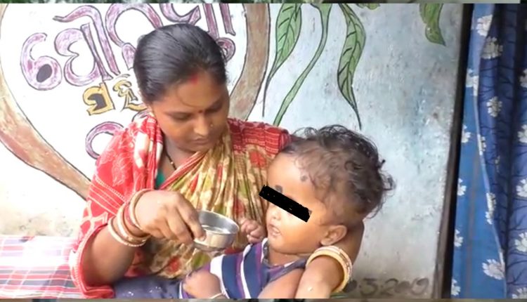 Head Of 4 Year Child Increasing In Sonepur, Family Seeks Help For Treatment