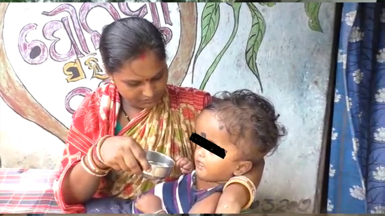 Head Of 4 Year Child Increasing In Sonepur, Family Seeks Help For Treatment