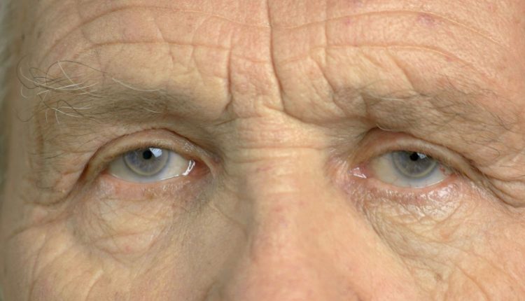 After Cataract Surgery 6 Patients Of Kanpur Lost Their Eyesight