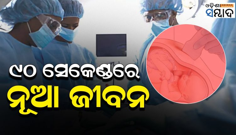 Delhi Aiims Doctors Perform Risky Balloon Dilation Surgery On Fetus Heart