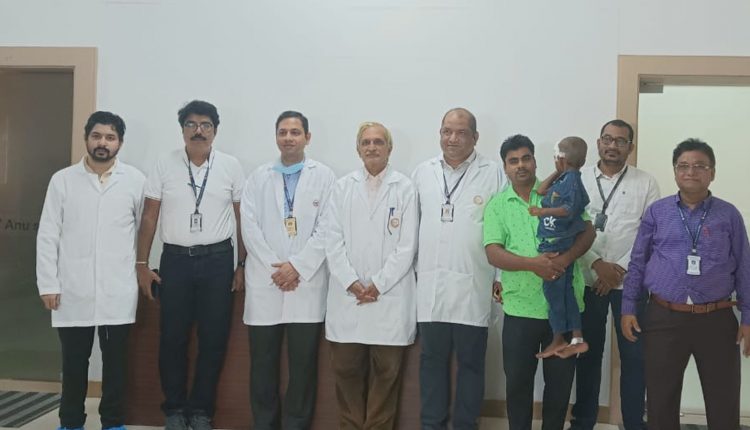 SUM SURGEONS CONDUCT RARE SURGERY TO TREAT CHILD SUFFERING FROM ENCEPHALOCOELES