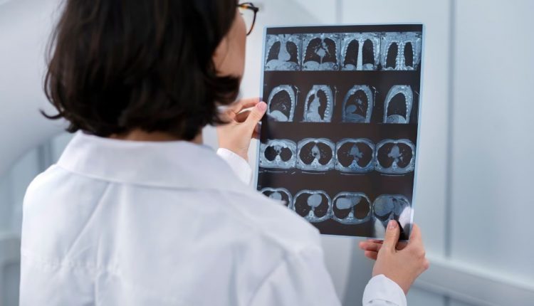 KIMS docs with a team from IIT Indore propose model of quick detection of lung pathology