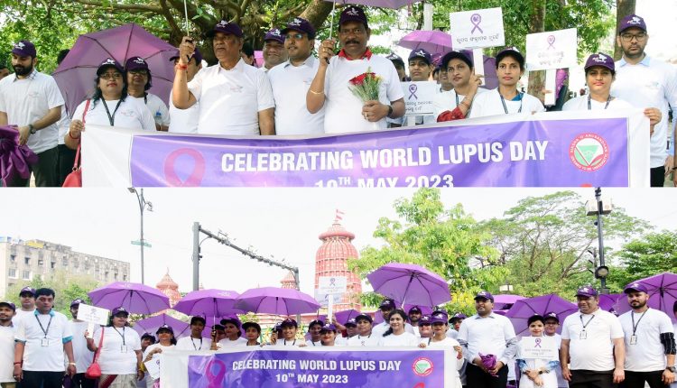 World Lupus Day celebrated at SOA